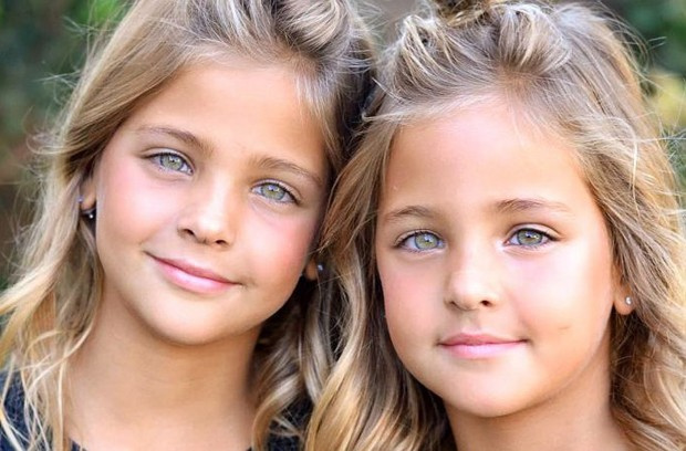 Aos 8 Anos Elas São Consideradas As Irmãs Gêmeas Mais Bonitas Do Mundo