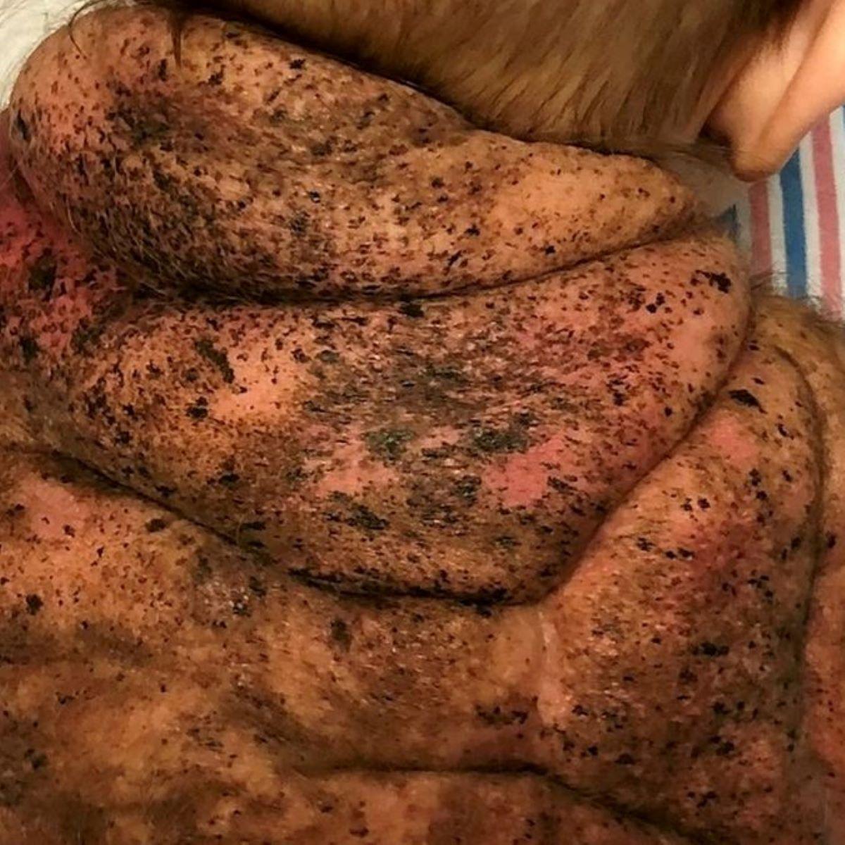 Beb nasce com casca de tartaruga nas costas veja fotos - RIC Mais