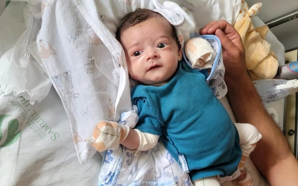 Morre beb diagnosticado com doena rara que torna pele to frgil quanto asas de borboleta em MG Foto Arquivo Pessoal