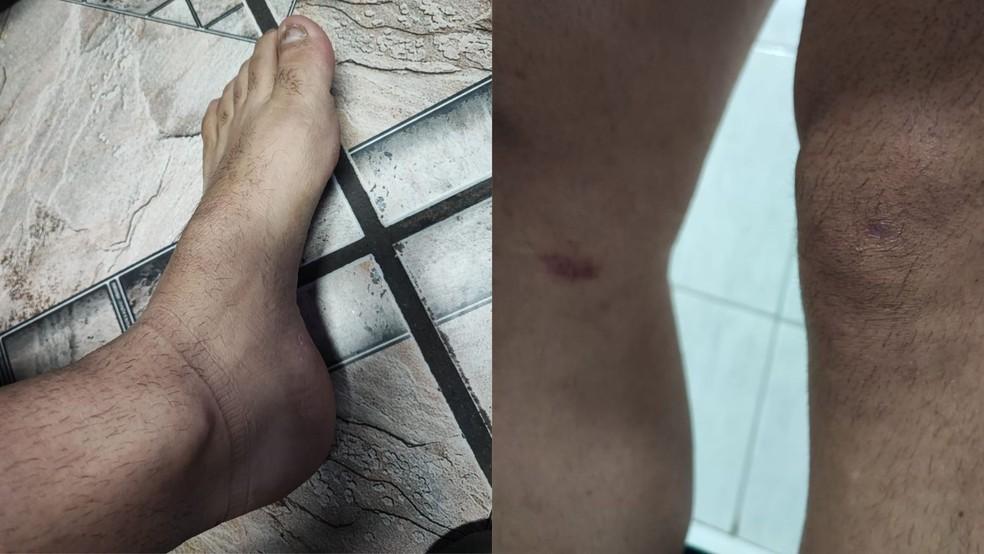 Homem espancado alega ter ficado com vrios hematomas pelo corpo em Botucatu SP Foto Arquivo Pessoal