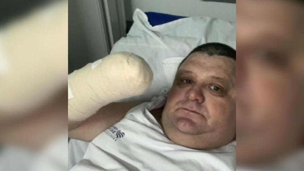 Humorista Pilha mostra foto em hospital com a mo amputada Foto Reproduo