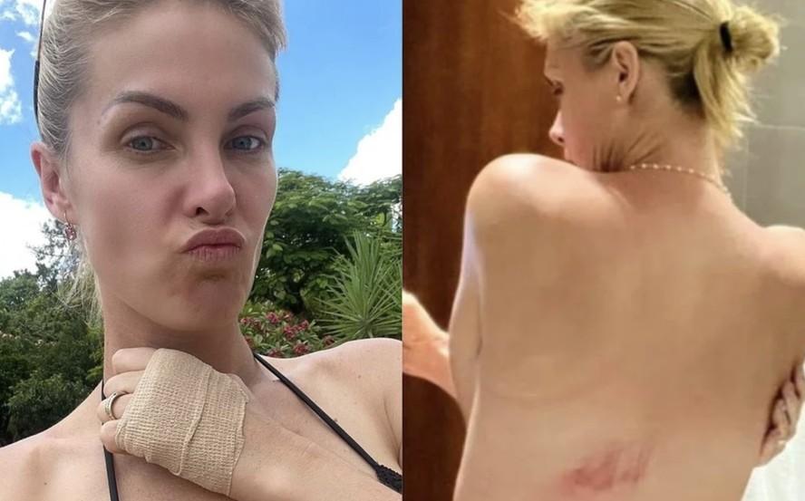 Image: https://mulherinteressante.com/wp-content/uploads/2023/11/postiimg-6552b5eac167d5405.png Ana Hickmann