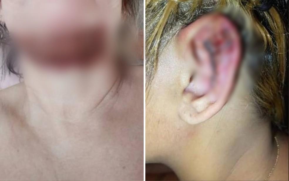 Pacientes de dentista ficam deformados aps cirurgias estticas em Goinia Foto DivulgaoPolcia Civil