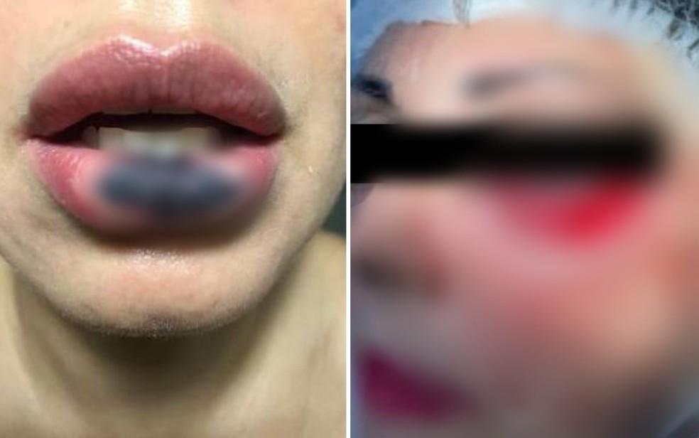 Dentista suspeita de deformar pacientes ao realizar cirurgias estticas em Goinia Gois Foto DivulgaoPolcia Civil