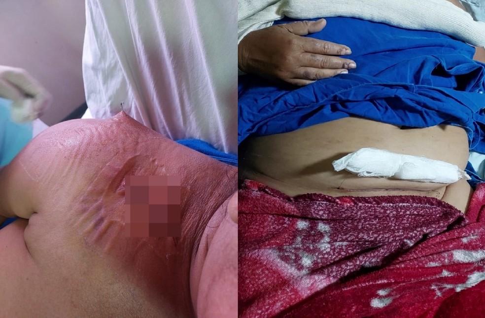 Paraense Rosangela Cavalcante de 42 anos que teve o tero retirado em uma cirurgia errada no PA Foto Divulgao