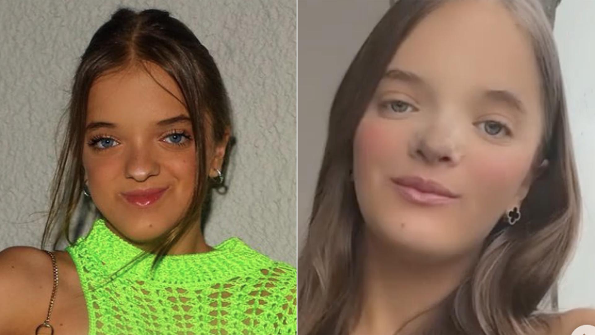 Antes e depois da rinoplastia de Rafaella Justus - Foto Reproduo Instagram