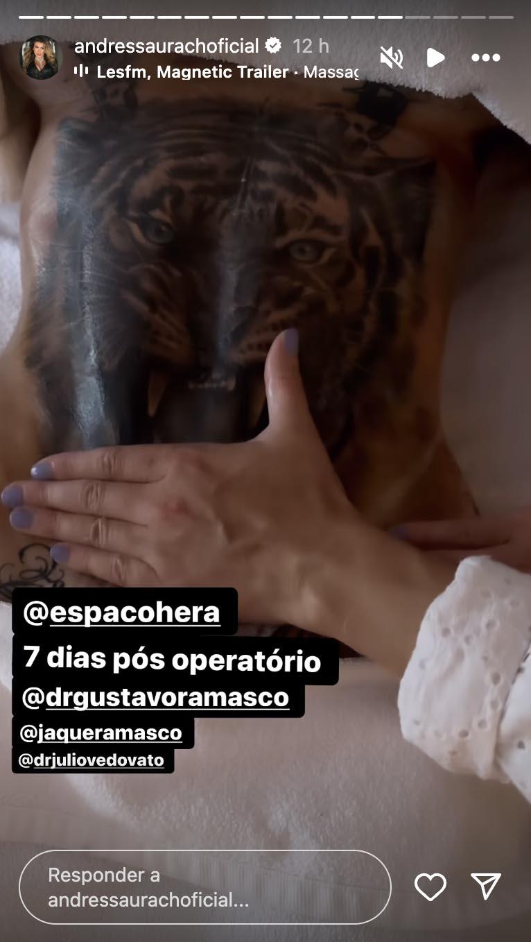 Image: https://mulherinteressante.com/wp-content/uploads/2024/03/postiimg-65fdb4bb7f0441569.jpg Andressa Urach mostra sua cintura aps remover as costelas - Foto Reproduo Instagram