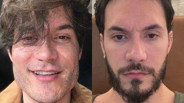 Eliezer mostra antes e depois de reverter harmonizao facial - ReproduoInstagram