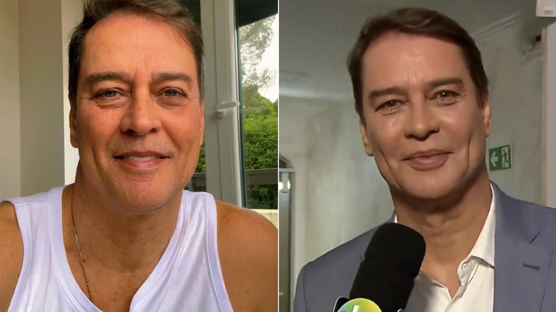 Antes e depois Marcello Antony exibe o resultado da harmonizao facial - Fotos Reproduo Instagram e SBT