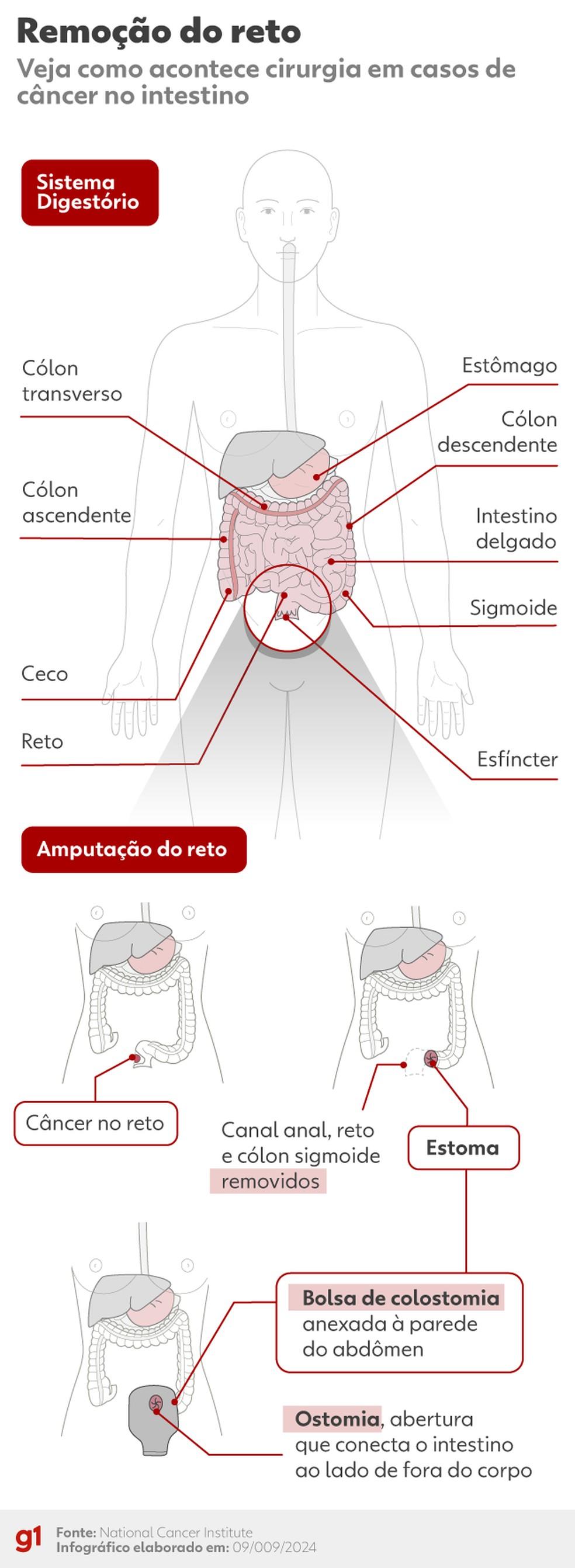 Remoo do reto Foto Arteg1