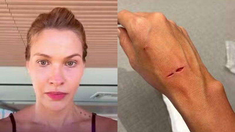 Andressa Suita desabafou aps o box do banheiro estourar em sua mo - ReproduoInstagram