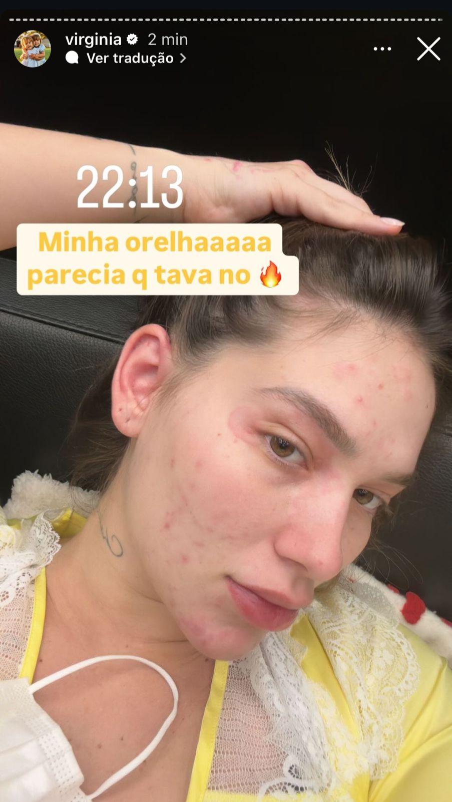 Image: https://mulherinteressante.com/wp-content/uploads/2024/09/postiimg-66e2ea0e71ea11853.jpeg Virginia Fonseca internada aps apresentar piora nos sintomas - ReproduoInstagram