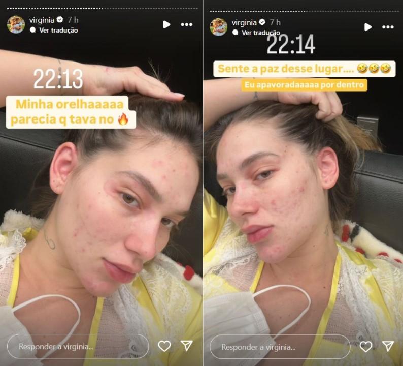 Virginia Fonseca mostra reao alrgica - Reproduo Instagram