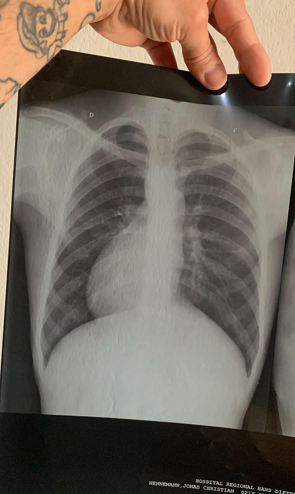 Raio-x do jovem mostra corao do lado inverso Foto Arquivo pessoal