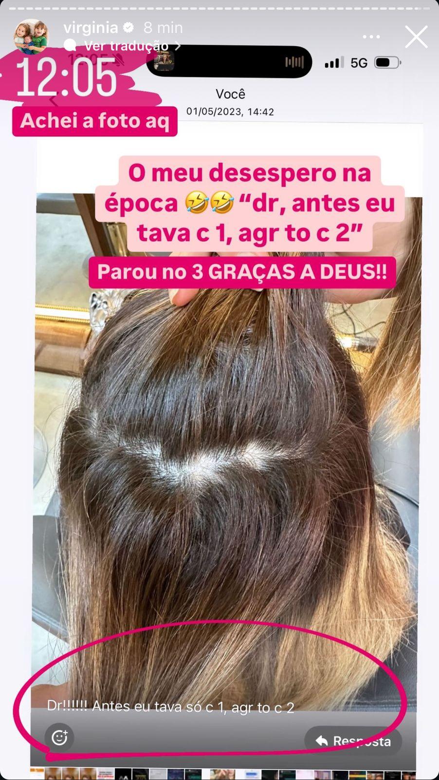 Virginia fala sobre queda de cabelo aps revelar novo visual - ReproduoInstagram