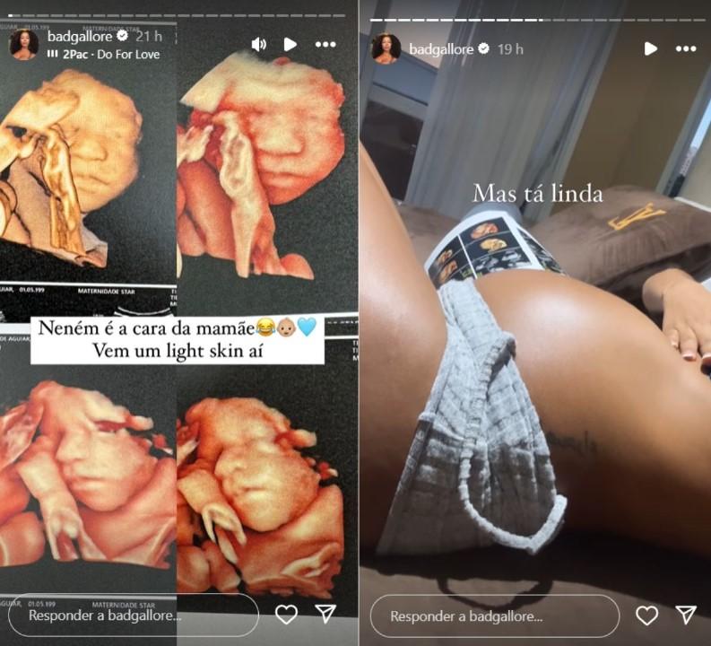 Lorena Maria mostra rosto do filho em ultrassom - Reproduo Instagram