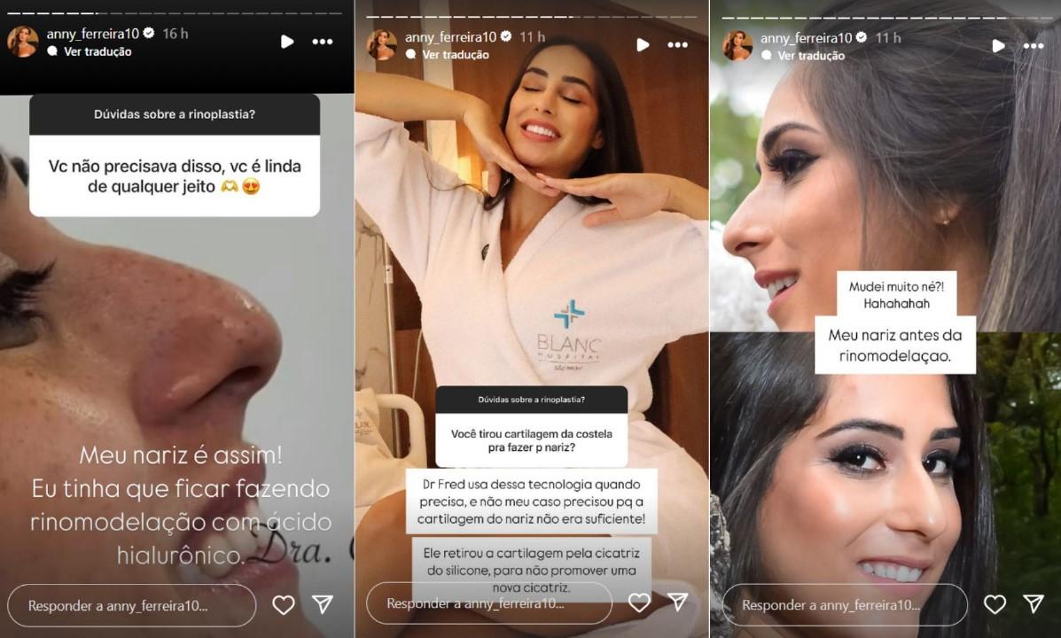 Ex-BBB Deniziane fala sobre rinoplastia - Reproduo Instagram