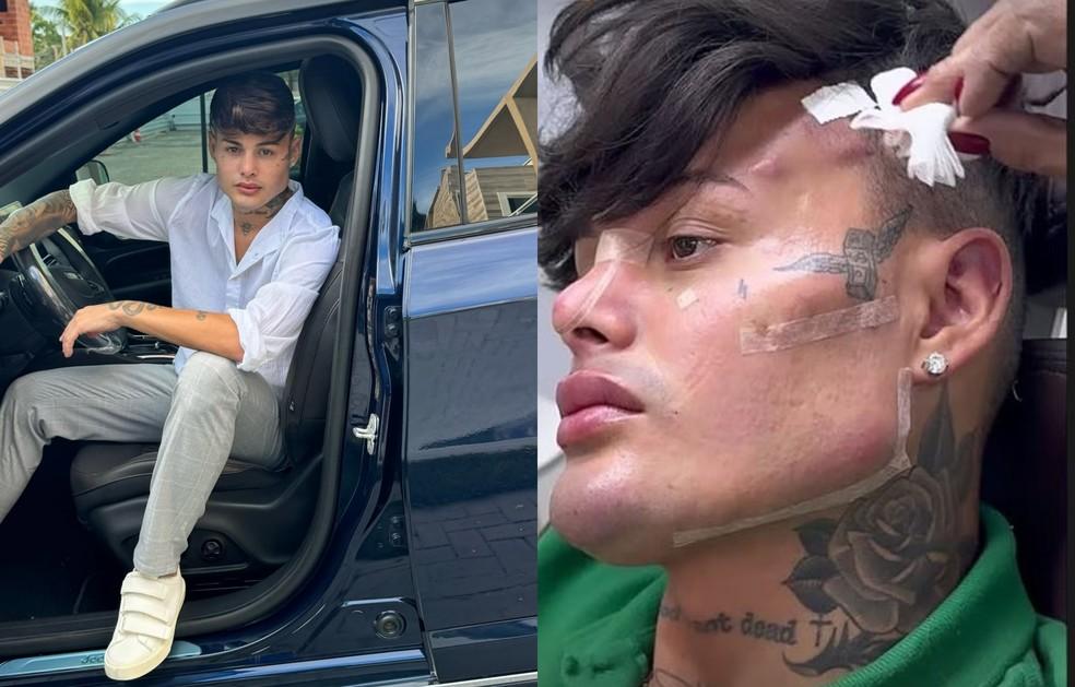 Influenciador Gleiciano Azevedo Junior afirmou que gastou mais de R 100 mil em cirurgia Foto Reproduo Instagram