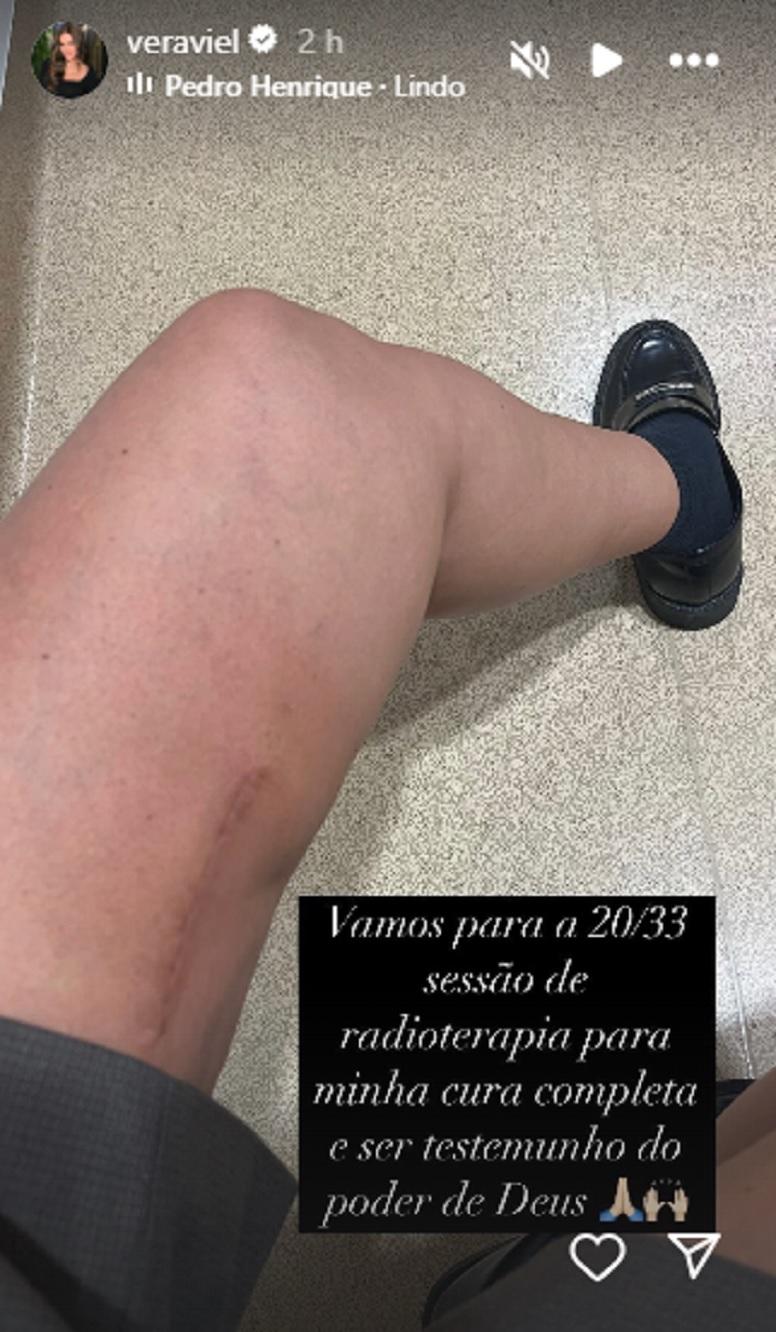 Vera Viel Stories