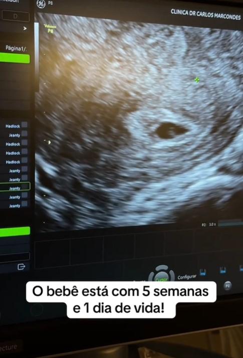 Mara Cardi mostra primeiro ultrassom do terceiro filho - ReproduoTikTok