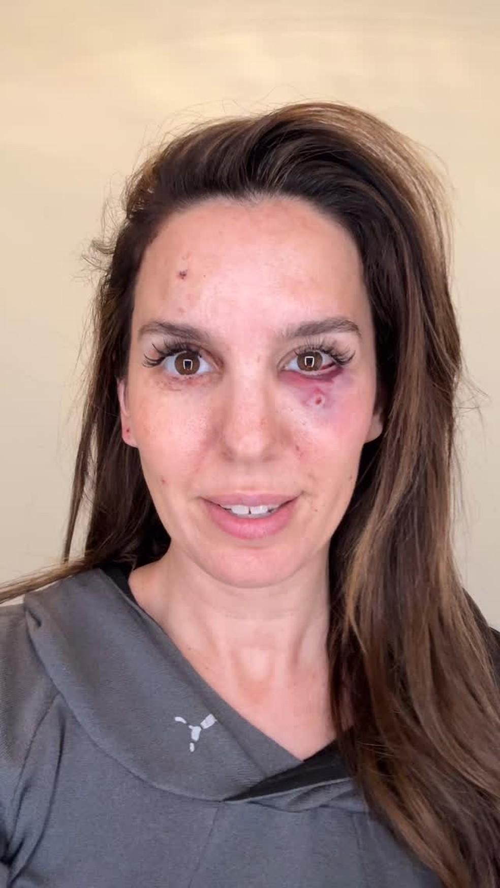 Christy Carlson Romano leva tiros no rosto Foto ReproduoInstagram