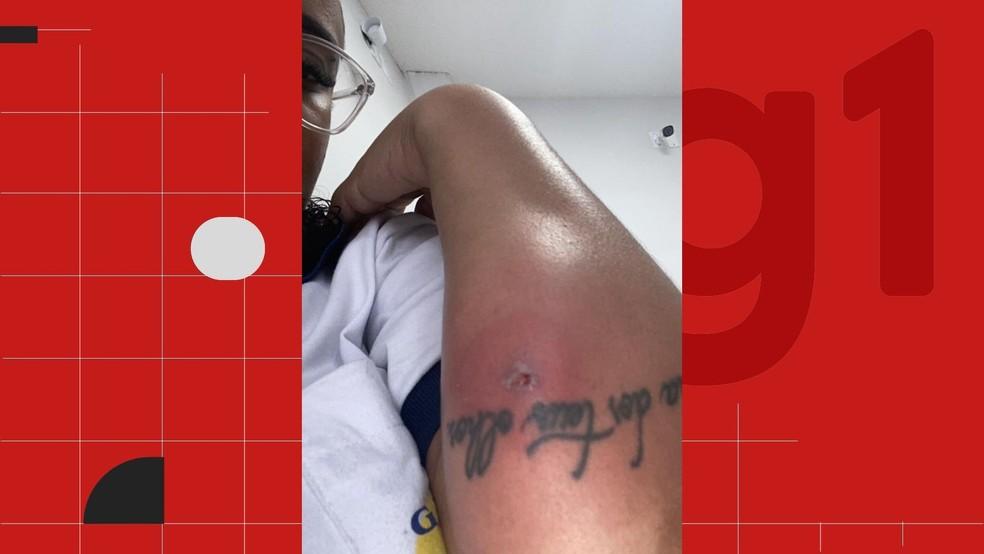 Jessica Avelino de 26 anos ficou paraplgica aps complicao causada por furnculo Esprito Santo Foto Arquivo pessoal