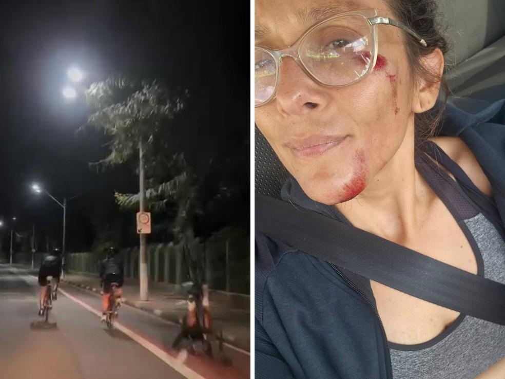 Ciclista fica ferida aps atropelar capivara em ciclovia do Taquaral Foto Nicole HeinrichDivulgao - Gabriela MeirelesArquivo Pessoal