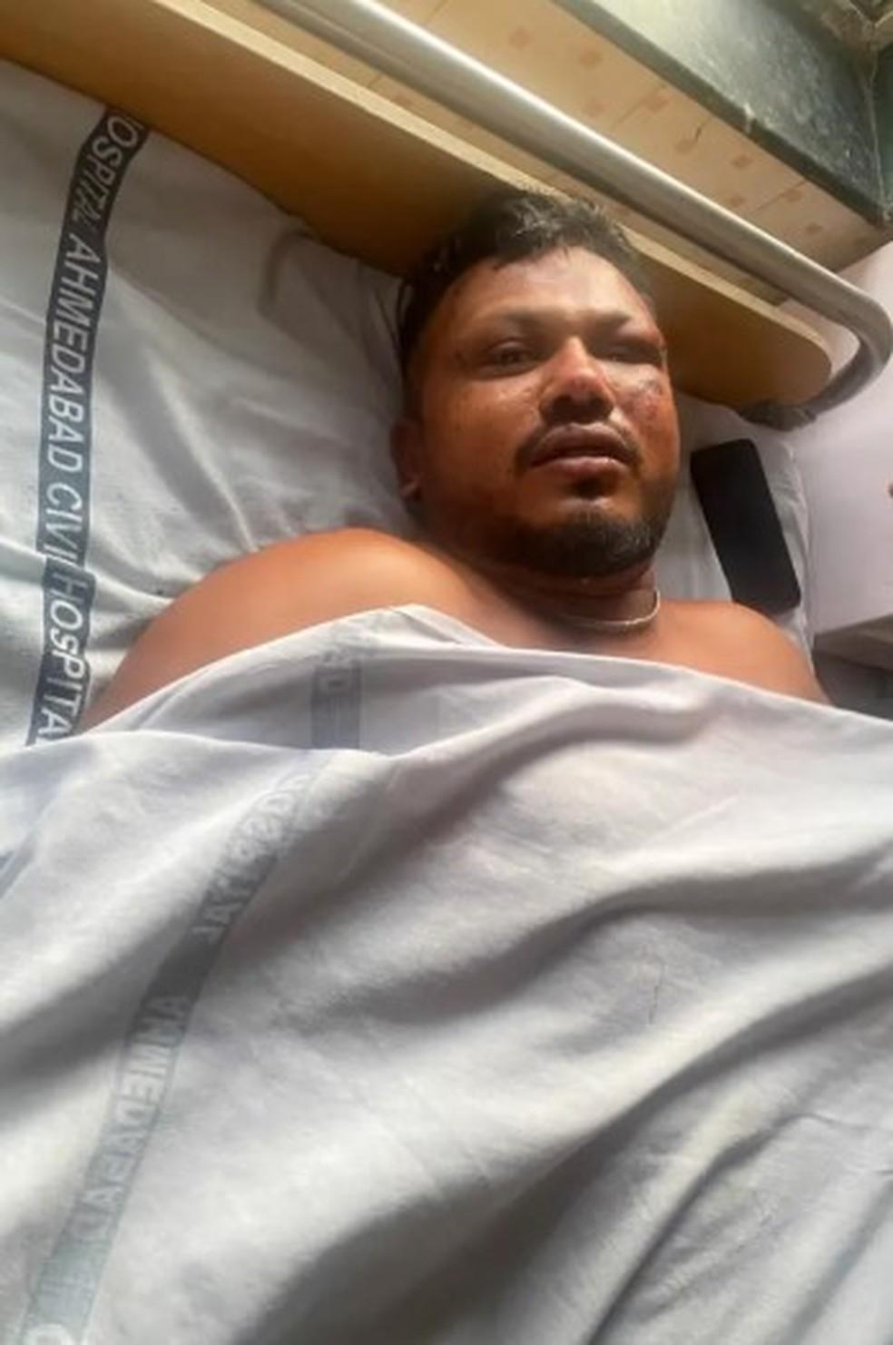 Vishwash Kumar Ramesh de 40 anos o nico sobrevivente de acidente que matou 241 a bordo de avio da Air India Foto Reproduo