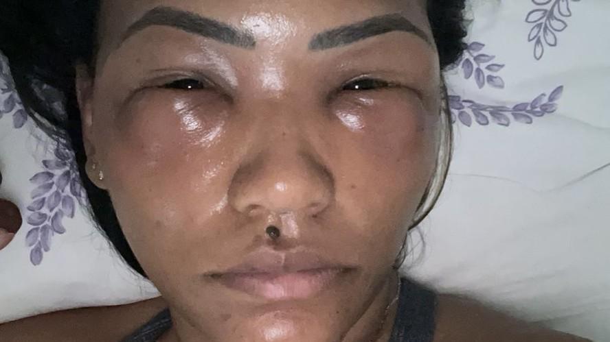 Embora Marina tenha levado a situao com graa e leveza nas redes sociais ela conta que o desenrolar da situao prejudicou bastante sua sade emocional