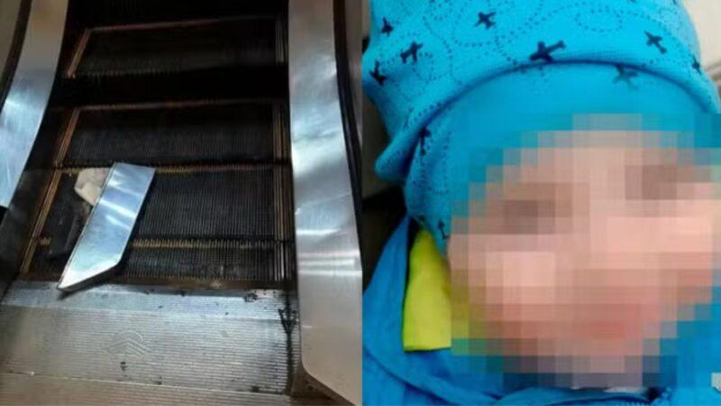 Brao de criana de 2 anos arrancado em escada rolante de shopping - Reproduo