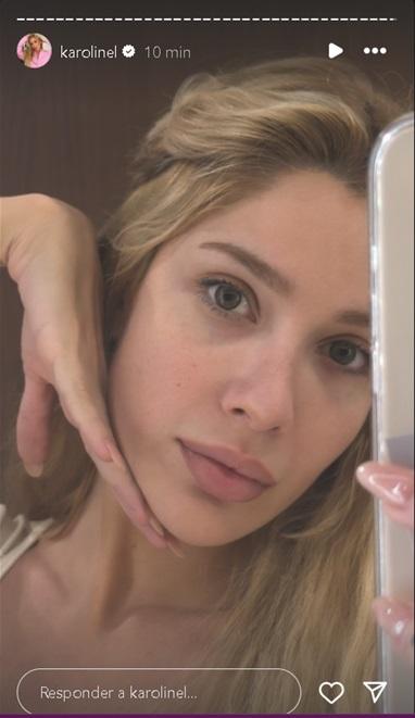 Karoline Lima passa por procedimentos estticos Foto Reproduo intagram karolinel