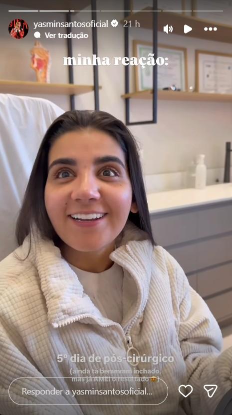 Yasmin Santos mostra resultado da rinoplastia - ReproduoInstagram yasminsantosoficial 