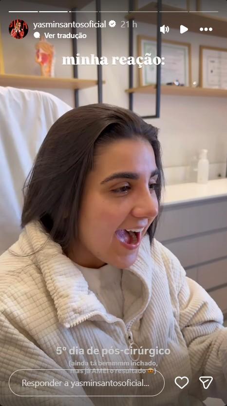 Yasmin Santos mostra resultado da rinoplastia - ReproduoInstagram yasminsantosoficial 