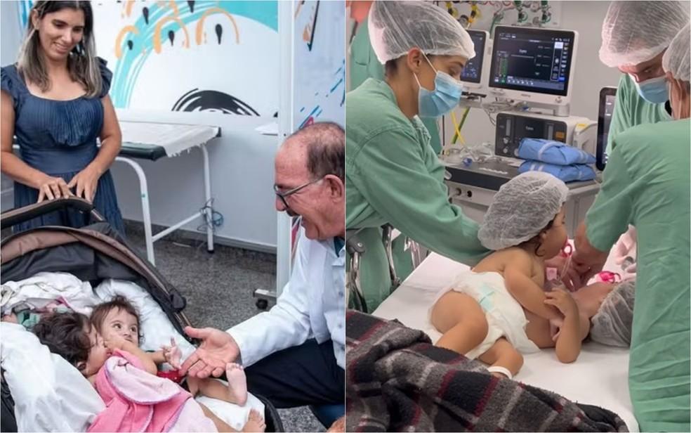 Gmeas siamesas Kiraz e Aruna de 1 anos e 6 meses de So Paulo passam por cirurgia em Goinia Gois Foto ReproduoRedes Sociais
