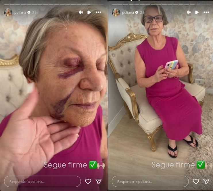 Eponina Rocha Foto Reproduo Instagram