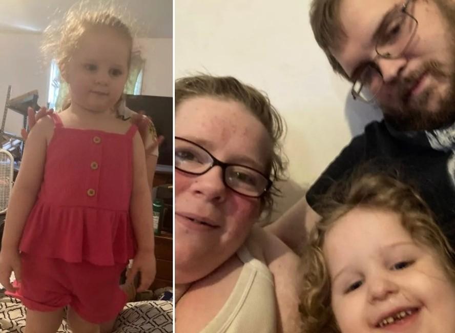 Joycelynn Ann Dylewski que tinha 3 anos morreu aps contrair grave infestao de piolhos